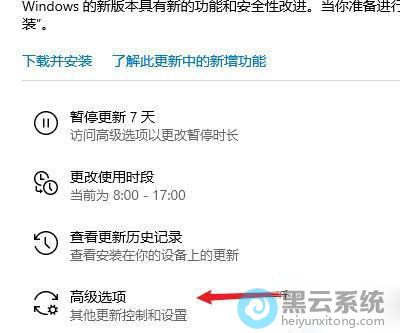 ����߼�ѡ��